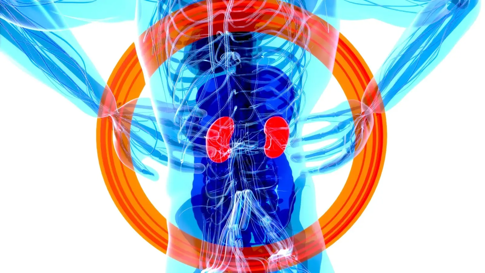 Why Are Kidney Stones So Likely To Return After The First Occurrence