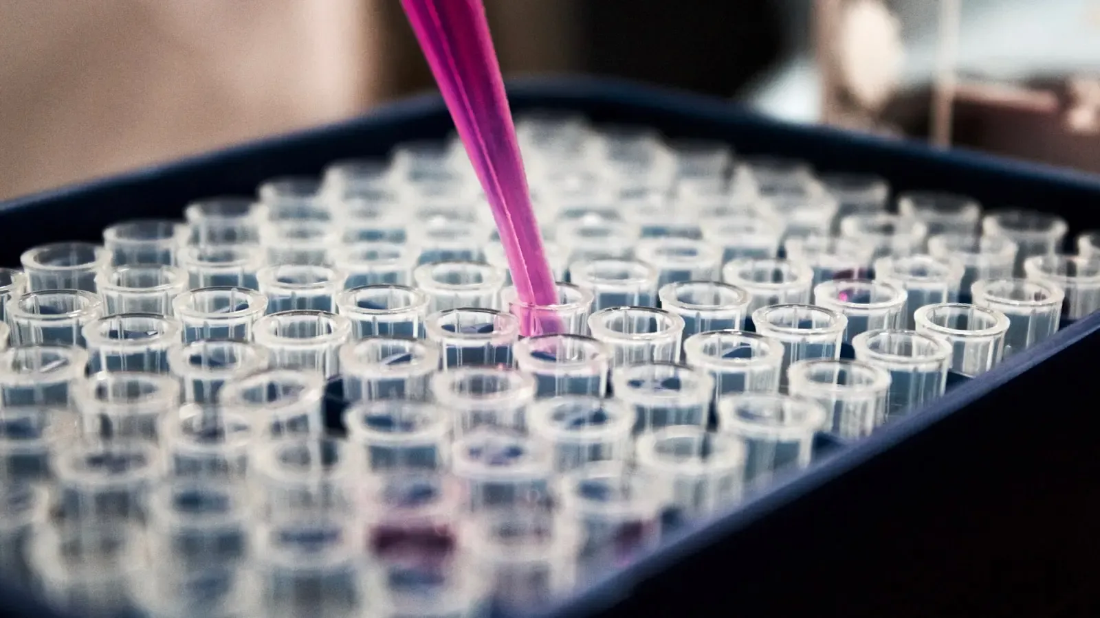 Hidden Brain Cells Emerge as New Front in Alzheimer’s War